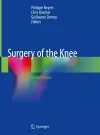 Surgery of the Knee cover