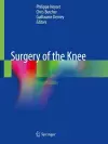 Surgery of the Knee cover