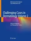 Challenging Cases in Dermatology Volume 2 cover