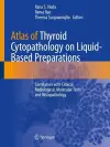 Atlas of Thyroid Cytopathology on Liquid-Based Preparations cover