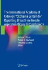 The International Academy of Cytology Yokohama System for Reporting Breast Fine Needle Aspiration Biopsy Cytopathology cover