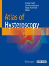 Atlas of Hysteroscopy cover