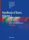 Handbook of Burns Volume 2 cover