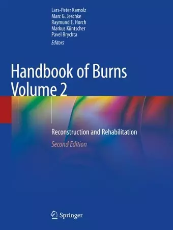 Handbook of Burns Volume 2 cover