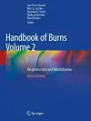 Handbook of Burns Volume 2 cover