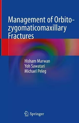 Management of Orbito-zygomaticomaxillary Fractures cover
