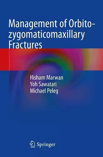 Management of Orbito-zygomaticomaxillary Fractures cover