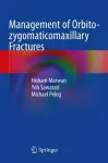 Management of Orbito-zygomaticomaxillary Fractures cover