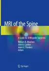 MRI of the Spine cover