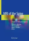 MRI of the Spine cover