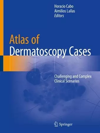 Atlas of Dermatoscopy Cases cover