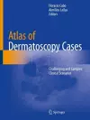 Atlas of Dermatoscopy Cases cover