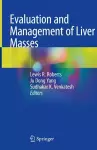 Evaluation and Management of Liver Masses cover