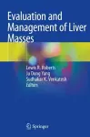 Evaluation and Management of Liver Masses cover