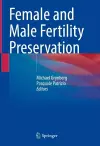 Female and Male Fertility Preservation cover