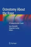 Osteotomy About the Knee cover