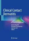 Clinical Contact Dermatitis cover