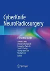 CyberKnife NeuroRadiosurgery cover