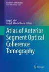 Atlas of Anterior Segment Optical Coherence Tomography cover
