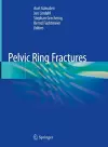 Pelvic Ring Fractures cover