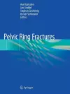 Pelvic Ring Fractures cover