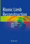 Bionic Limb Reconstruction cover