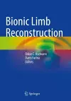 Bionic Limb Reconstruction cover