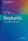 Blepharitis cover