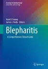 Blepharitis cover