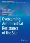 Overcoming Antimicrobial Resistance of the Skin cover