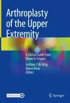 Arthroplasty of the Upper Extremity cover