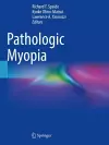 Pathologic Myopia cover