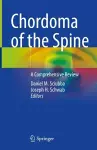 Chordoma of the Spine cover