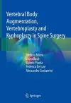 Vertebral Body Augmentation, Vertebroplasty and Kyphoplasty in Spine Surgery cover