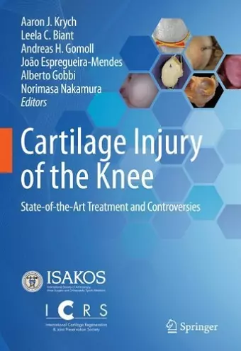 Cartilage Injury of the Knee cover