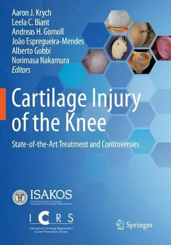 Cartilage Injury of the Knee cover