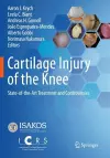 Cartilage Injury of the Knee cover