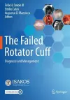 The Failed Rotator Cuff cover