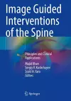 Image Guided Interventions of the Spine cover