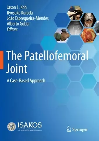 The Patellofemoral Joint cover