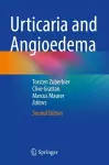 Urticaria and Angioedema cover