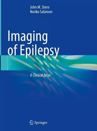 Imaging of Epilepsy cover