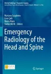 Emergency Radiology of the Head and Spine cover