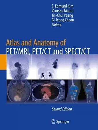 Atlas and Anatomy of PET/MRI, PET/CT and SPECT/CT cover