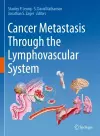 Cancer Metastasis Through the Lymphovascular System cover