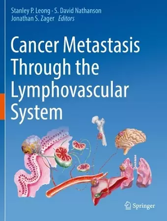 Cancer Metastasis Through the Lymphovascular System cover