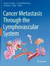 Cancer Metastasis Through the Lymphovascular System cover