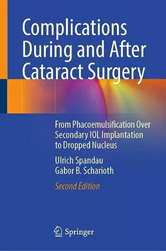 Complications During and After Cataract Surgery cover