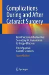 Complications During and After Cataract Surgery cover