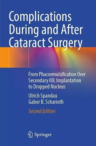 Complications During and After Cataract Surgery cover